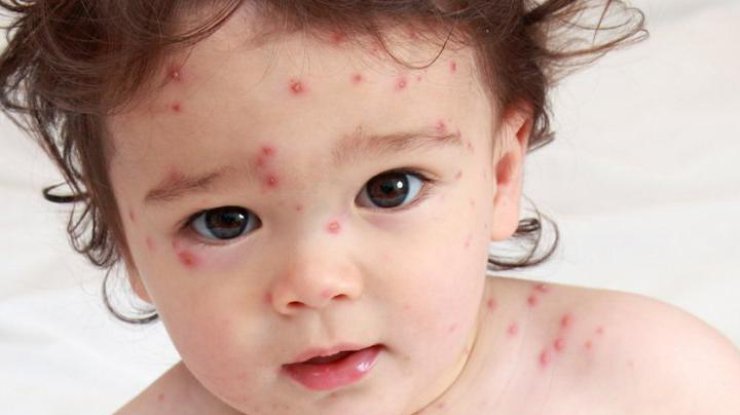 Шановні жителі Березівського району!