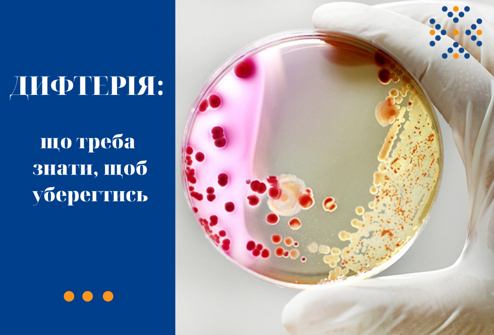 Дифтерія: що треба знати, щоб уберегтись