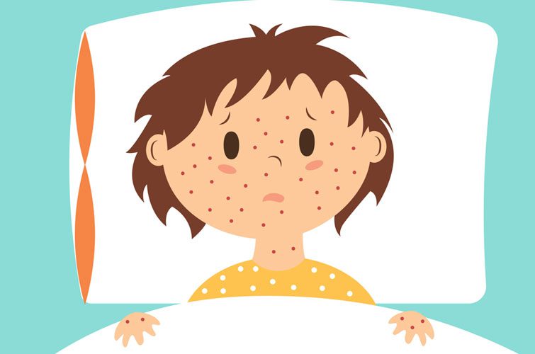 Що треба знати про КІР