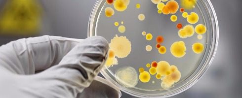 КИШКОВІ ІНФЕКЦІЇ