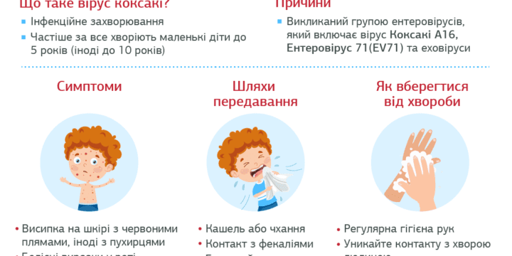 Вірус Коксакі